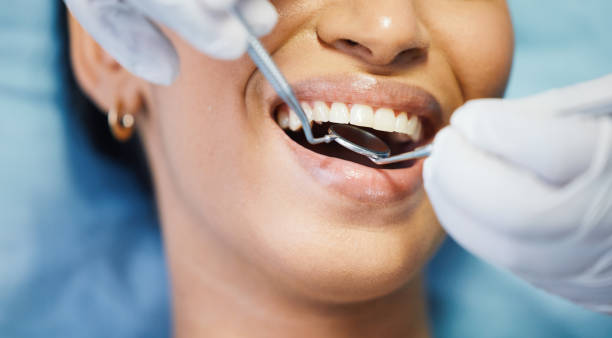 Best Emergency Wisdom Teeth Removal in Yorktown, TX